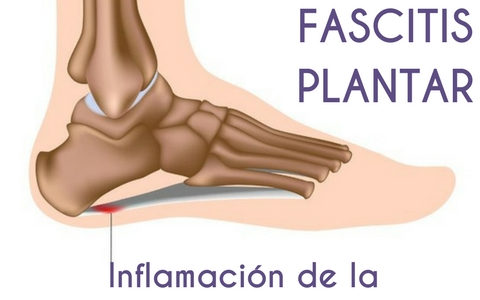 Fisioterapia y calidad de vida